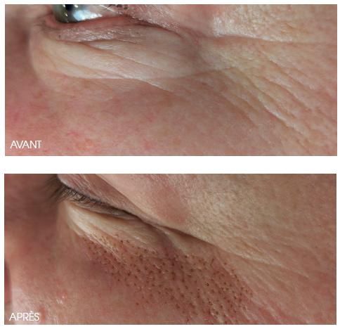 Dermatologie esthétique à Grenoble